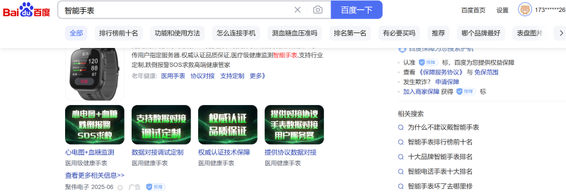 智能手表